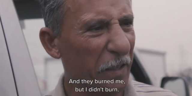Iraqi Christian Survives Being Burned Alive By ISIS